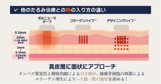 LIANの３つの特徴