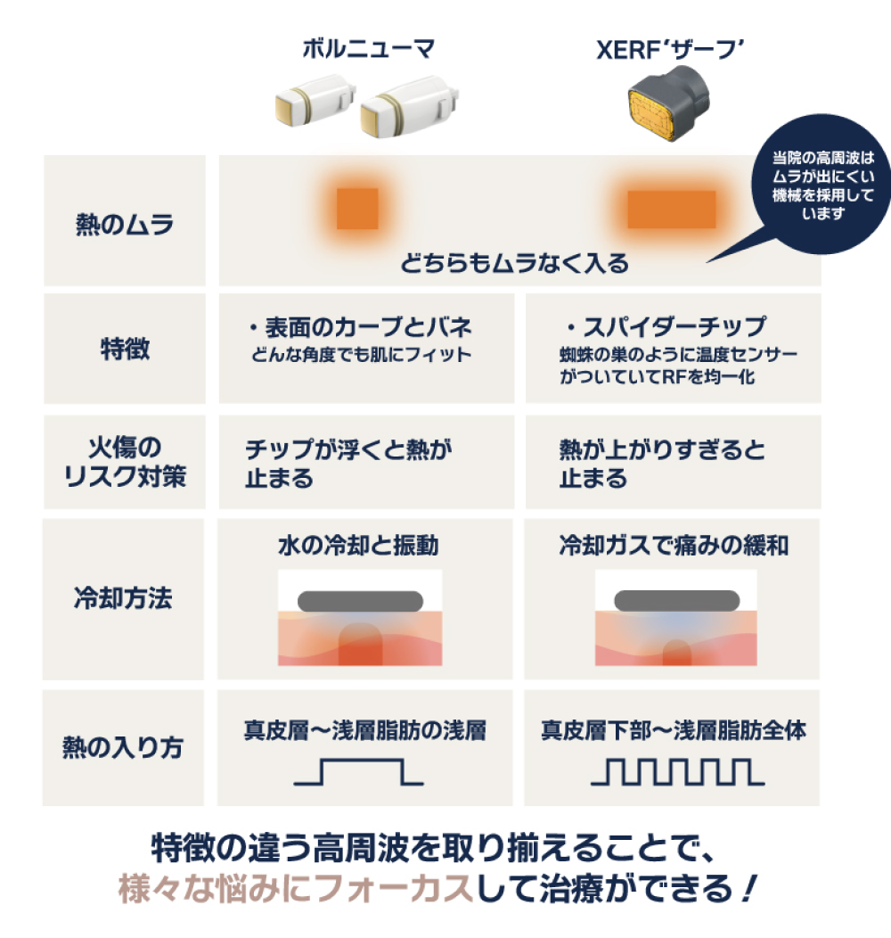 高周波機械による違い