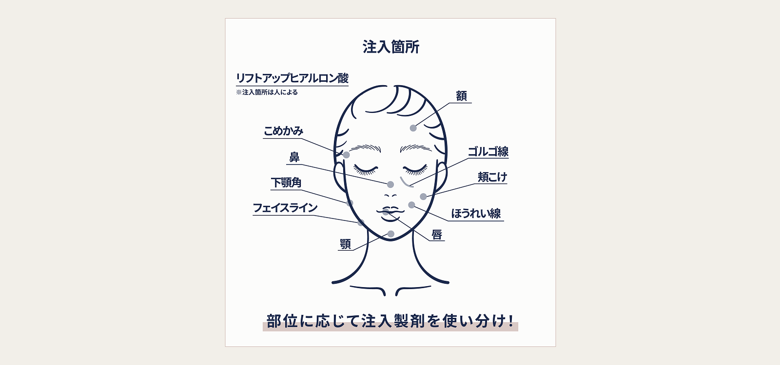 注射可能な部位
