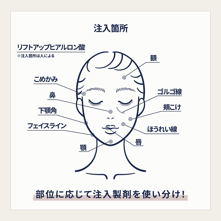 注射可能な部位