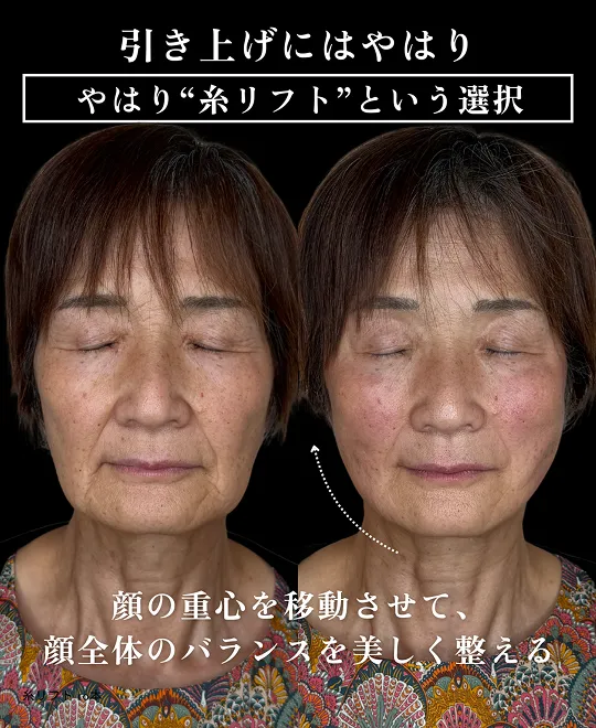 症例写真