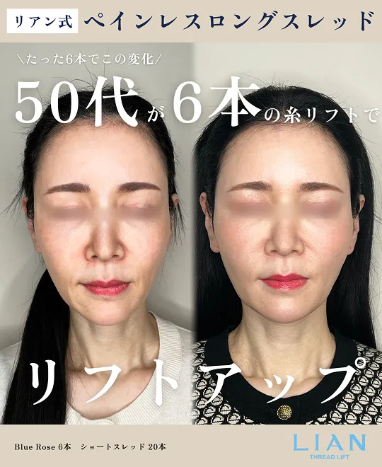 症例写真