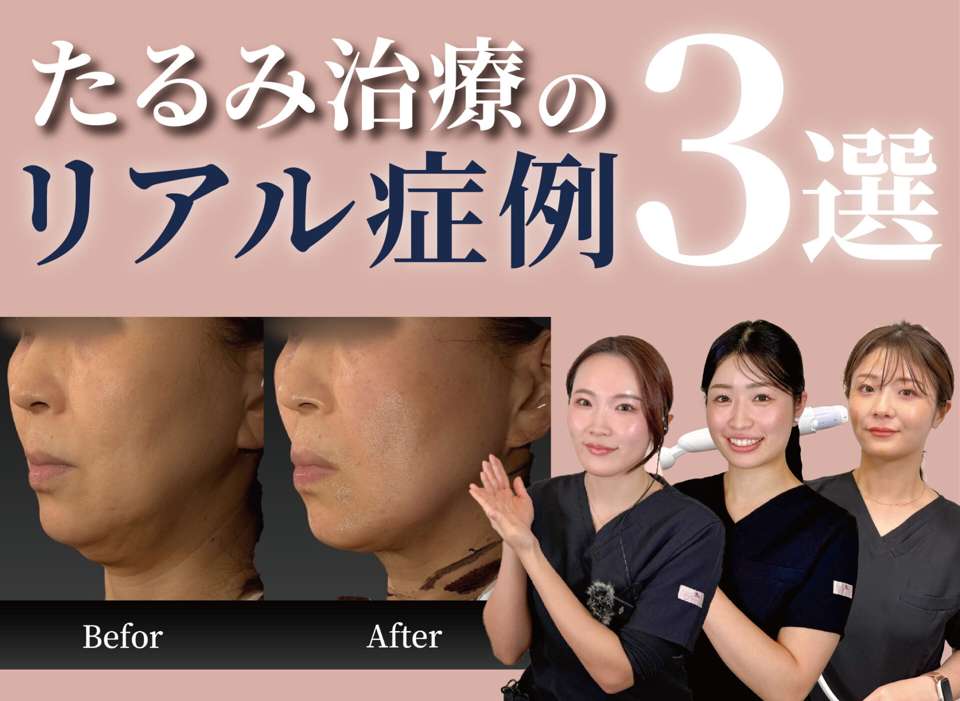 【Youtube】看護師による症例3選動画をUPしました。