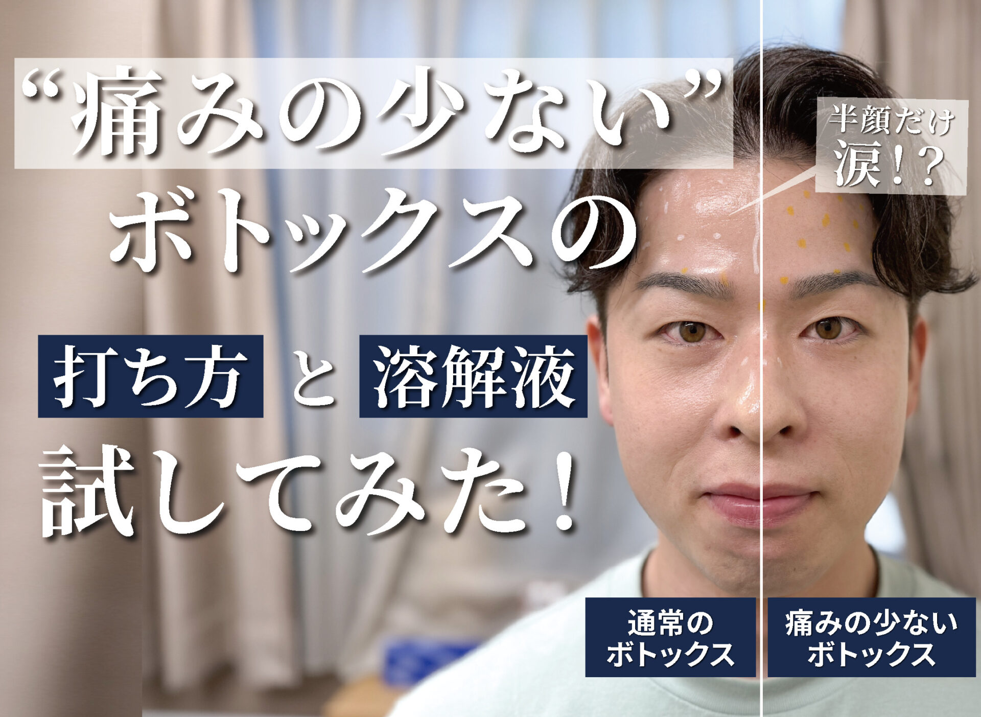 【Youtube】２種類のボトックスを使用した半顔企画動画をUPしました‼︎