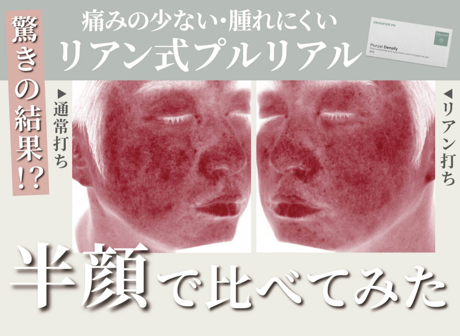 【Youtube】大人気半顔企画！プルリアルデンシファイについての動画をUPしました‼︎