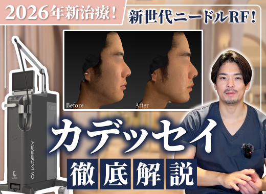 【Youtube】2026年新治療！新世代ニードルRFカデッセイについての動画をUPしました。