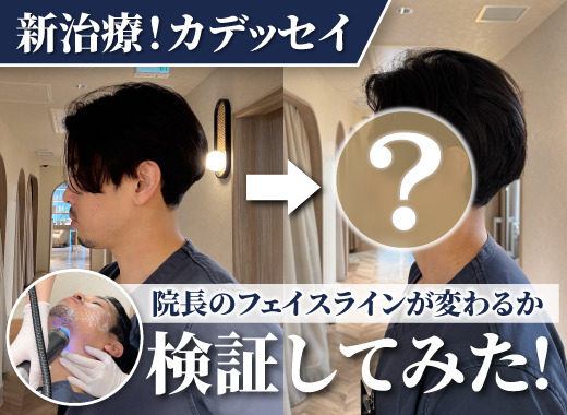 【Youtube】リアル検証！新治療カデッセイで院長のフェイスラインが変わるか徹底検証した動画をUPしました！