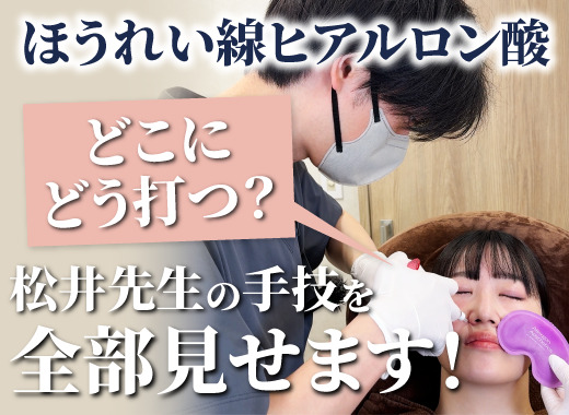 【Youtube】ほうれい線ヒアルロン酸はどこにどう打つ？松井副院長の手技を完全公開した動画をUPしました！