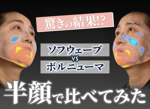 【Youtube】どっちを選ぶ？ソフウェーブ vs ボルニューマの解説動画をUPしました！