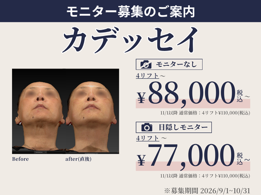 カデッセイモニター募集(目隠し)