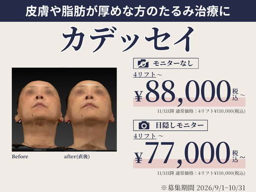 カデッセイ