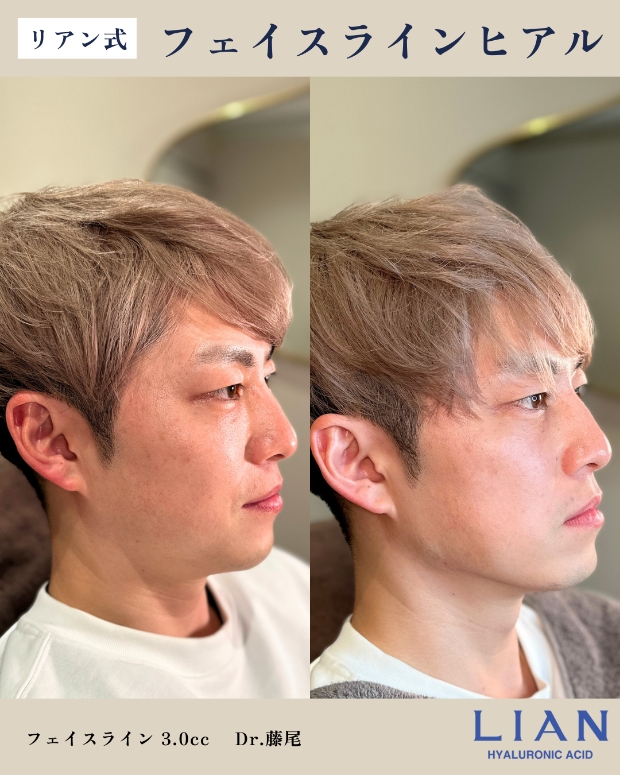 症例写真