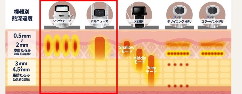 ソフウェーブとボルニューマの違い