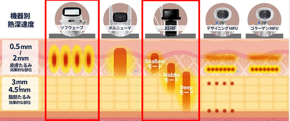 ザーフとソフウェーブの違い